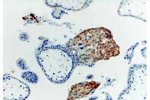 Immunohistochemistry staining with anti-human HLA-G (MEM-G/1) of first trimester placenta (paraffin-embedded sections).