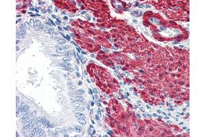 Anti-TAGLN / SM22 antibody IHC of human uterus. (Transgelin anticorps  (AA 190-201))