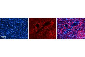 Rabbit Anti-CPT2 Antibody   Formalin Fixed Paraffin Embedded Tissue: Human Liver Tissue Observed Staining: Cytoplasm in hepatocytes Primary Antibody Concentration: N/A Other Working Concentrations: 1:600 Secondary Antibody: Donkey anti-Rabbit-Cy3 Secondary Antibody Concentration: 1:200 Magnification: 20X Exposure Time: 0.