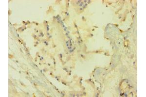 Immunohistochemistry of paraffin-embedded human prostate tissue using ABIN7167024 at dilution of 1:100 (AKT1 anticorps  (AA 1-480))