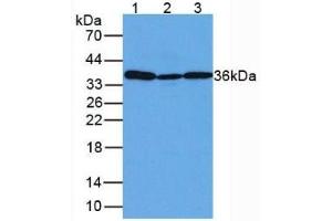 Rabbit Detection antibody from the kit in WB with Positive Control: Sample Lane1: Human Liver Tissue; Lane2: Mouse Lung Tissue; Lane3: Mouse Placenta. (GAPDH Kit ELISA)