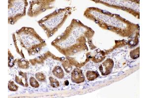 anti-UDP-Galactose-4-Epimerase (GALE) (AA 1-340) antibody