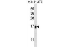 Western Blotting (WB) image for anti-Ribosomal Protein L35 (RPL35) antibody (ABIN2997048) (RPL35 anticorps)