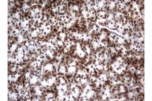 Image no. 10 for anti-Vimentin (VIM) (AA 210-466) antibody (ABIN1491200)