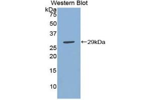 Western blot analysis of the recombinant protein. (IKbIP anticorps  (AA 78-301))