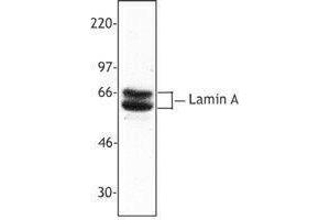 Western Blotting (WB) image for anti-Lamin A/C (LMNA) antibody (ABIN2666171) (Lamin A/C anticorps)