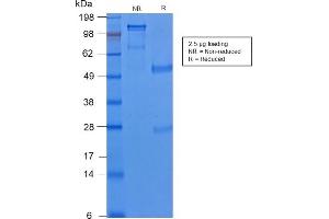 SDS-PAGE Analysis of Purified Cytokeratin 8 Rabbit Recombinant Monoclonal Antibody (KRT8/2174R). (Recombinant KRT8 anticorps)