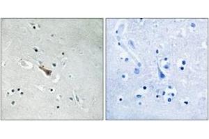 Immunohistochemistry analysis of paraffin-embedded human brain, using APLP2 (Phospho-Tyr755) Antibody.