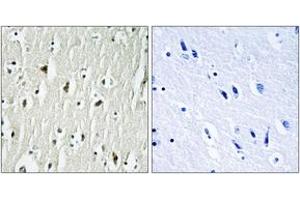 Immunohistochemistry analysis of paraffin-embedded human brain tissue, using CSK (Ab-364) Antibody.