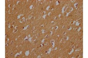 IHC image of ABIN7148487 diluted at 1:200 and staining in paraffin-embedded human brain tissue performed on a Leica BondTM system. (CNTNAP3B anticorps  (AA 26-256))