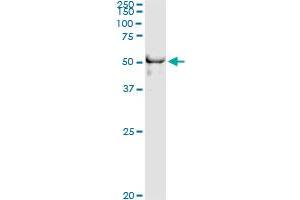 Immunoprecipitation of DYX1C1 transfected lysate using anti-DYX1C1 monoclonal antibody and Protein A Magnetic Bead , and immunoblotted with DYX1C1 MaxPab rabbit polyclonal antibody.