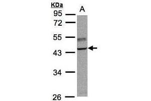 WB Image Sample(30 ug whole cell lysate) A:Raji , 10% SDS PAGE antibody diluted at 1:3000 (TRAF1 anticorps)