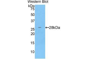 Western blot analysis of the recombinant protein. (CTSC anticorps  (AA 231-463))
