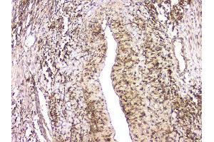 IHC analysis of HECTD3 using anti-HECTD3 antibody (ABIN6719595).