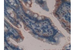 Detection of GAL9 in Mouse Small intestine Tissue using Polyclonal Antibody to Galectin 9 (GAL9)