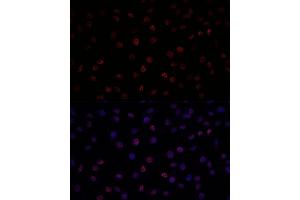 Immunofluorescence analysis of L929 using SF3B1 antibody (ABIN7270543) at dilution of d100 (40x lens).