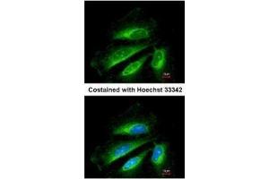 ICC/IF Image Immunofluorescence analysis of methanol-fixed HeLa, using SDHB, antibody at 1:200 dilution.