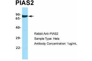 Host:  Rabbit  Target Name:  PIAS2  Sample Type:  Hela  Antibody Dilution:  1.