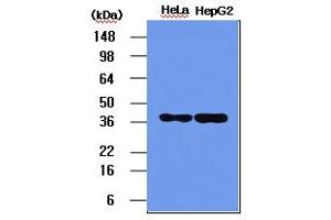Western blot analysis: The HeLa and HepG2 cell lysates (5ug) were resolved by SDS-PAGE, transferred to PVDF membrane and probed with anti-human NPM (1:1000). (NPM1 anticorps)