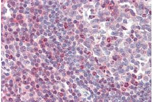 Human Tonsil (formalin-fixed, paraffin-embedded) stained with ZAP70 antibody ABIN461961 at 20 ug/ml followed by biotinylated anti-mouse IgG secondary antibody ABIN481714, alkaline phosphatase-streptavidin and chromogen. (ZAP70 anticorps)