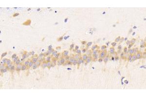 Detection of RETN in Rat Cerebrum Tissue using Polyclonal Antibody to Resistin (RETN) (Resistin anticorps  (AA 45-114))