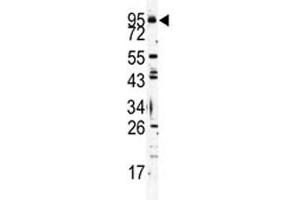 Western blot analysis of TLR6 antibody and K562 lysate