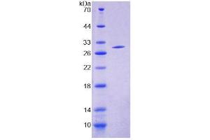 Image no. 1 for Acyl-CoA Synthetase Medium-Chain Family Member 1 (ACSM1) (AA 370-557) protein (T7 tag,His tag) (ABIN6239498)