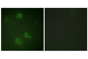 Immunofluorescence analysis of A549 cells, using NMDAR1 (Phospho-Ser890) antibody. (GRIN1/NMDAR1 anticorps  (pSer890))