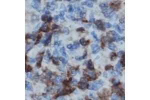 Immunohistochemical analysis of LCK staining in human lymph node formalin fixed paraffin embedded tissue section. (LCK anticorps)