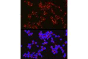 Immunofluorescence analysis of SH-SY5Y cells using  Rabbit pAb (ABIN6129958, ABIN6136993, ABIN6136994 and ABIN6222595) at dilution of 1:50 (40x lens). (APLP1 anticorps  (AA 39-300))