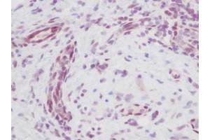 Image no. 5 for anti-Melanoma Inhibitory Activity (MIA) antibody (ABIN464851) (MIA anticorps)