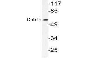 Western blot (WB) analyzes of Dab1 antibody in extracts from HeLa cells. (DAB1 anticorps)