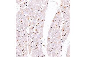 Immunohistochemistry of paraffin embedded rat heart using TFIIIC110 (ABIN7074038) at dilution of 1:2500 (400x lens)