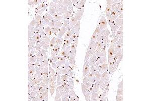 Immunohistochemistry of paraffin embedded rat heart using TFIIIC110 (ABIN7074038) at dilution of 1:2500 (400x lens) (GTF3C2 anticorps)