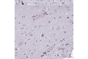 Immunohistochemical staining (Formalin-fixed paraffin-embedded sections) of human lateral ventricle with MOBP polyclonal antibody  shows strong dot-like positivity.