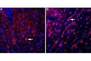 Expression of Glutamate receptor δ1 in rat cortex and medial septum - Immunohistochemical staining of perfusion-fixed frozen rat brain sections using Anti-GRID1 (extracellular) Antibody (ABIN7043235, ABIN7044374 and ABIN7044375), (1:400).