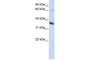 WB Suggested Anti-ST6GALNAC1 Antibody Titration:  0.