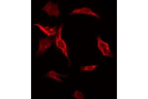 ABIN6272672 staining HT-29 by IF/ICC. (HTR3D anticorps)