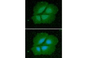 ICC/IF analysis of Cyclophilin B in Hep3B cells line, stained with DAPI (Blue) for nucleus staining and monoclonal anti-human Cyclophilin B antibody (1:100) with goat anti-mouse IgG-Alexa fluor 488 conjugate (Green). (PPIB anticorps)