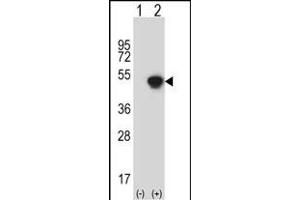 Western blot analysis of GCAT (arrow) using rabbit polyclonal GCAT Antibody (N-term) (ABIN656823 and ABIN2846034).