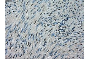 Immunohistochemical staining of paraffin-embedded endometrium tissue using anti-CRYABmouse monoclonal antibody. (CRYAB anticorps)