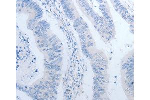Immunohistochemistry (IHC) image for anti-Neurogenin 1 (NEUROG1) antibody (ABIN1873884) (Neurogenin 1 anticorps)