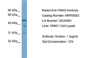 WB Suggested Anti-TINAG  Antibody Titration: 0. (TINAG anticorps  (Middle Region))