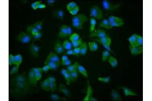 Immunofluorescence staining of MCF-7 cells with ABIN7171412 at 1:266, counter-stained with DAPI. (TCP1 alpha/CCTA anticorps  (AA 406-506))