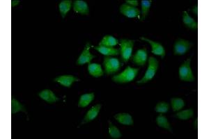 Immunofluorescence staining of A549 cells with ABIN7167130 at 1:100, counter-stained with DAPI. (RASSF3 anticorps  (AA 2-109))