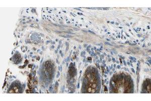 ABIN6274510 at 1/100 staining Mouse intestine tissue by IHC-P. (Sema4a anticorps  (Internal Region))