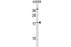 Western Blotting (WB) image for anti-Nescient Helix Loop Helix 2 (NHLH2) antibody (ABIN2998885) (NHLH2 anticorps)