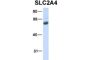 Host:  Rabbit  Target Name:  SLC2A4  Sample Type:  Human Fetal Lung  Antibody Dilution:  1.