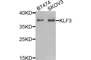 Western blot analysis of extracts of BT474 and SKOV3 cells, using KLF3 antibody.
