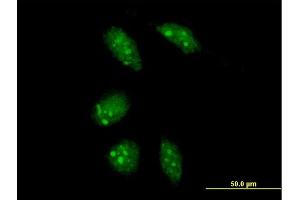 Immunofluorescence of purified MaxPab antibody to GLTSCR2 on HeLa cell. (GLTSCR2 anticorps  (AA 1-478))
